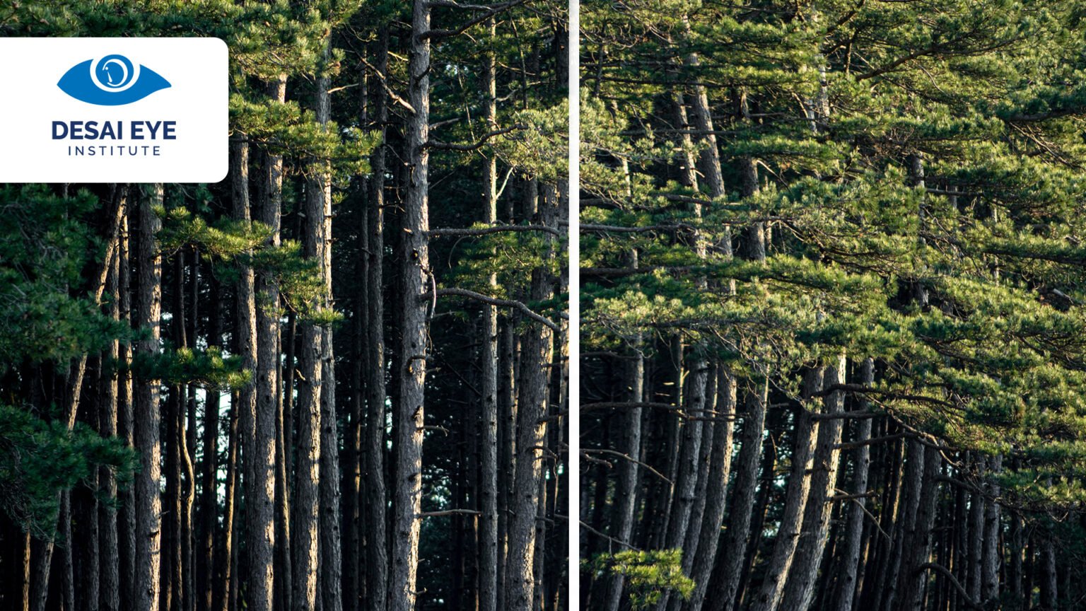 Metamorphopsia (Distorted Vision) – Causes, Symptoms, and Treatment ...