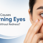 Burning Eyes Without Redness
